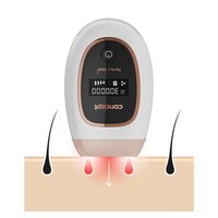 Фотоэпилятор Concept IL3020 Perfect Skin IPL - Изображение №3 — Chaika Market