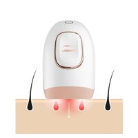Фотоэпилятор Concept IL3000 IPL Perfect Skin - Изображение №2 — Chaika Market